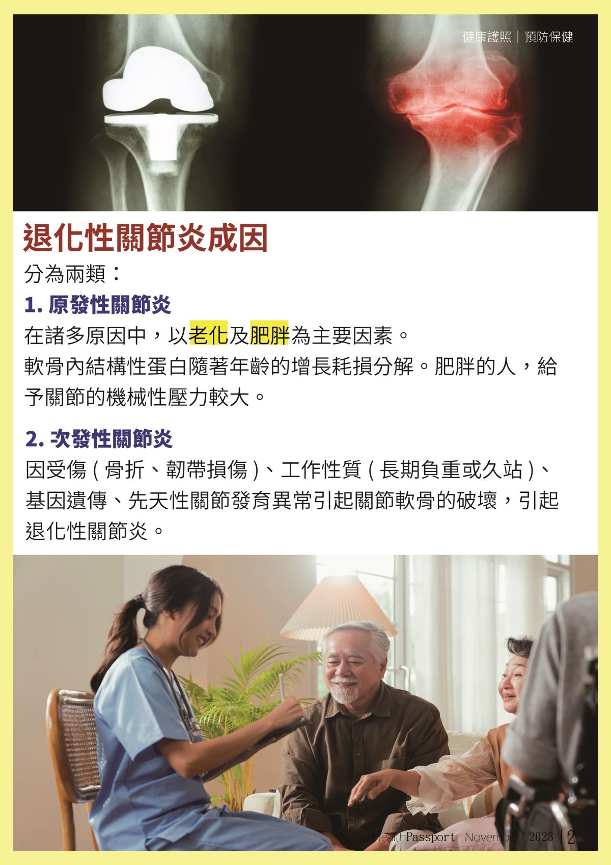 退化性關節炎 卡卡活動不順 關節靈活的關鍵